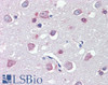 45-586 (5ug/ml) staining of paraffin embedded Human Colon. Steamed antigen retrieval with citrate buffer pH 6, AP-staining.