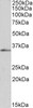 45-602 (1ug/ml) staining of HepG2 nuclear lysate (35ug protein in RIPA buffer) . Primary incubation was 1 hour. Detected by chemiluminescence