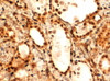 45-608 (2ug/ml) staining of paraffin embedded Human Thyroid Gland. Steamed antigen retrieval with Tris/EDTA buffer pH 9, HRP-staining.