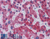 45-773 (0.5ug/ml) staining of Human Lymph Node (A) , Spleen (B) and Placenta (C) lysates (35ug protein in RIPA buffer) . Detected by chemiluminescence.