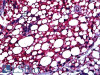 42-086 (3.75ug/ml) staining of paraffin embedded Human Renal Tubules. Steamed antigen retrieval with citrate buffer pH 6, AP-staining. <strong>This data is from a previous batch, not on sale.</strong>