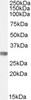 HEK293 overexpressing KU70 and probed with 45-817 (mock transfection in first lane) .