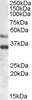 45-823 (2.5ug/ml) staining of paraffin embedded Human Colon. Steamed antigen retrieval with citrate buffer pH 6, AP-staining.