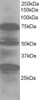 45-843 staining (1ug/ml) of Human Lung lysate (RIPA buffer, 30ug total protein per lane) . Primary incubated for 1 hour. Detected by western blot using chemiluminescence.