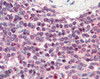 45-849 (3ug/ml) staining of paraffin embedded Human Spleen. Steamed antigen retrieval with citrate buffer pH 6, AP-staining. <strong>This data is from a previous batch, not on sale.</strong>