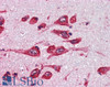 45-862 (0.5ug/ml) as the reporter antibody.