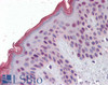 45-868 (2.5ug/ml) staining of paraffin embedded Human Colon. Steamed antigen retrieval with citrate buffer pH 6, AP-staining.