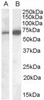 45-883 (1ug/ml) staining of Rat Testis lysate (35ug protein in RIPA buffer) . Detected by chemiluminescence.