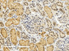 45-886 (5ug/ml) staining of paraffin embedded Human Small Intestine. Steamed antigen retrieval with citrate buffer pH 6, AP-staining.