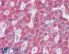 45-903 (0.5ug/ml) staining of Human Frontal Cortex lysate (35ug protein in RIPA buffer) . Primary incubation was 1 hour. Detected by chemiluminescence.