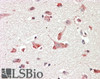 45-918 (1.25ug/ml) staining of paraffin embedded Human Skeletal Muscle. Steamed antigen retrieval with citrate buffer pH 6, AP-staining.
