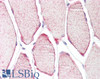 45-920 (3.75ug/ml) staining of paraffin embedded Human Skeletal Muscle. Steamed antigen retrieval with citrate buffer pH 6, AP-staining.