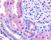 45-921 (0.1ug/ml) staining of Human Bone Marrow lysate (35ug protein in RIPA buffer) . Primary incubation was 1 hour. Detected by chemiluminescence.