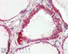 45-940 (0.1ug/ml) staining of Human Kidney lysate (35ug protein in RIPA buffer) . Primary incubation was 1 hour. Detected by chemiluminescence.