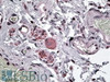 45-960 (0.3ug/ml) staining of Human Brain lysate (35ug protein in RIPA buffer) . Detected by chemiluminescence.