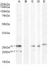 45-963 (0.1ug/ml) staining of Mouse Brain lysate (35ug protein in RIPA buffer) . Primary incubation was 1 hour. Detected by chemiluminescence.