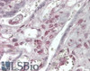 45-966 (0.1ug/ml) staining of Human Thyroid lysate (35ug protein in RIPA buffer) . Primary incubation was 1 hour. Detected by chemiluminescence.