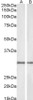 45-981 (1ug/ml) staining of Rat (A) and Pig (B) Kidney lysate (35ug protein in RIPA buffer) . Detected by chemiluminescence