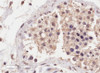 45-988 (5ug/ml) staining of paraffin embedded Human Breast. Steamed antigen retrieval with citrate buffer pH 6, AP-staining.