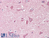 45-990 (0.5ug/ml) 48h-staining of PFA-perfused cryosection of Mouse Olfactory bulb. Antigen retrieval with citrate buffer pH 6 at 95C for 10min, IF-staning for NCAM2 (red) , VGLUT2 (blue) and NQO1 (green) , data obtained from customer.