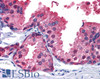 HEK293 overexpressing Human PDE4B and probed with 46-181 (mock transfection in first lane) .