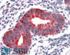 46-204 (1ug/ml) staining of Human Skin lysate (35ug protein in RIPA buffer) . Detected by chemiluminescence.