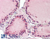 46-227 (0.3ug/ml) staining of Human Adrenal Gland lysate (35ug protein in RIPA buffer) . Primary incubation was 1 hour. Detected by chemiluminescence.