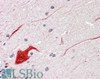 46-250 (3.75ug/ml) staining of paraffin embedded Human Cerebellum. Steamed antigen retrieval with citrate buffer pH 6, AP-staining. <strong>This data is from a previous batch, not on sale.</strong>