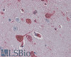 46-264 (0.1ug/ml) staining of HepG2 (A) , HeLa (B) , Jurkat (C) and MCF7 (D) lysates (35ug protein in RIPA buffer) . Primary incubation was 1 hour. Detected by chemiluminescence.