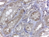 46-278 (1ug/ml) staining of Human Heart (A) , Mouse Heart (B) , Rat Heart (C) lysates (35ug protein in RIPA buffer) . Detected by chemiluminescence.