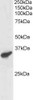 46-309 staining (1ug/ml) of Human Heart lysate (RIPA buffer, 30ug total protein per lane) . Primary incubated for 1 hour. Detected by western blot using chemiluminescence.