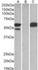 HEK293 lysate (10ug protein in RIPA buffer) overexpressing Human TRIM21 with C-terminal MYC tag probed with 46-314 (1ug/ml) in Lane A and probed with anti-MYC Tag (1/1000) in lane C. Mock-transfected HEK293 probed with 46-314 (1mg/ml) in Lane B. Detect