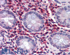 46-314 (5ug/ml) staining of paraffin embedded Human Colon. Steamed antigen retrieval with citrate buffer pH 6, AP-staining. <strong>This data is from a previous batch, not on sale.</strong>