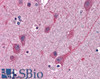 46-439 (3.75ug/ml) staining of paraffin embedded Human Cortex. Steamed antigen retrieval with citrate buffer pH 6, AP-staining. <strong>This data is from a previous batch, not on sale.</strong>