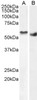 46-445 (2ug/ml) staining of nuclear HEK293 (A) and (1ug/ml) Human Breast cancer (B) lysate (35ug protein in RIPA buffer) . Detected by chemiluminescence.