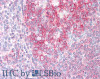 46-453 (5ug/ml) staining of paraffin embedded Human Tonsil. Steamed antigen retrieval with citrate buffer pH 6, AP-staining.