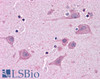 46-464 (5ug/ml) staining of paraffin embedded Human Cortex. Steamed antigen retrieval with citrate buffer pH 6, AP-staining.