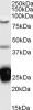 46-465 (1ug/ml) staining of Human Testes lysate (35ug protein in RIPA buffer) . Primary incubation was 1 hour. Detected by chemiluminescence.