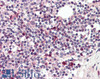 46-474 Negative Control showing staining of paraffin embedded Mouse Thymus, with no primary antibody.