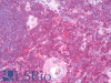 46-502 Flow cytometric analysis of paraformaldehyde fixed HeLa cells (blue line) , permeabilized with 0.5% Triton. Primary incubation 1hr (10ug/ml) followed by Alexa Fluor 488 secondary antibody (1ug/ml) . IgG control: Unimmunized goat IgG (black line) fol