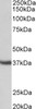 42-958 (1ug/ml) staining of A549 lysate (35ug protein in RIPA buffer) . Detected by chemiluminescence.