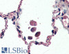 46-549 (3.75ug/ml) staining of paraffin embedded Human Skeletal Muscle. Steamed antigen retrieval with citrate buffer pH 6, AP-staining. <strong>This data is from a previous batch, not on sale.</strong>