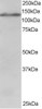 46-555 staining (1ug/ml) of Jurkat lysate (RIPA buffer, 30ug total protein per lane) . Primary incubated for 1 hour. Detected by chemiluminescence.