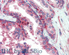 46-584 (5ug/ml) staining of paraffin embedded Human Prostate. Steamed antigen retrieval with citrate buffer pH 6, AP-staining. <strong>This data is from a previous batch, not on sale.</strong>