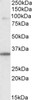 46-585 (3.8ug/ml) staining of paraffin embedded Human Prostate. Steamed antigen retrieval with citrate buffer pH 6, AP-staining.