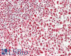 43-168 (5ug/ml) staining of paraffin embedded Human Liver. Steamed antigen retrieval with citrate buffer pH 6, AP-staining.