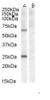 46-629 (5ug/ml) staining of paraffin embedded Human Thyroid. Steamed antigen retrieval with citrate buffer pH 6, AP-staining.