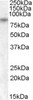 HEK293 overexpressing ESRRG and probed with 46-655 (mock transfection in first lane) .