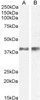 46-664 (0.3ug/ml) staining of human lymph node lysate (35ug protein in RIPA buffer) . Primary incubation was 1 hour. Detected by chemiluminescence.