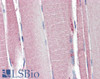 46-693 (5ug/ml) staining of paraffin embedded Human Adrenal Gland. Steamed antigen retrieval with citrate buffer pH 6, AP-staining. <strong>This data is from a previous batch, not on sale.</strong>